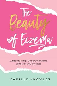 The Beauty of Eczema: A Guide To Living a Life Beyond Eczema Using The Hope Principles